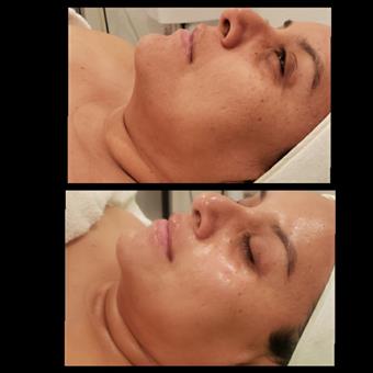 Fresh & Glow Skincare - Estheticians in Corona, CA